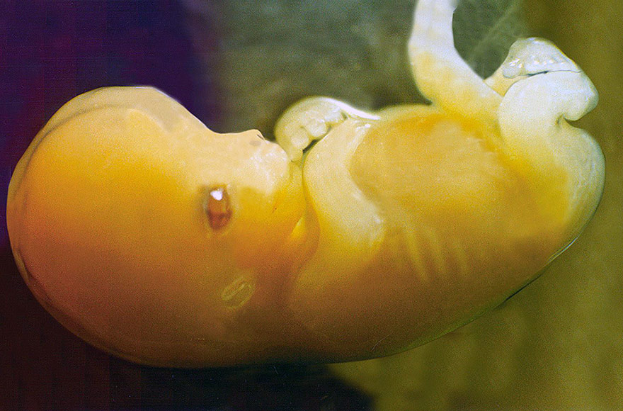 Embrião humano sete semanas após a concepção