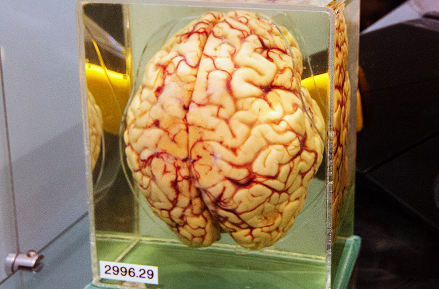 Cérebro humano preservado/Maksym Kozlenko - CC-BY-SA 4.0
