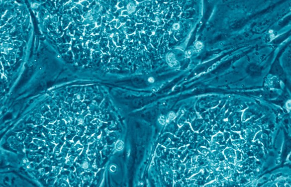 Células-tronco embrionárias humanas