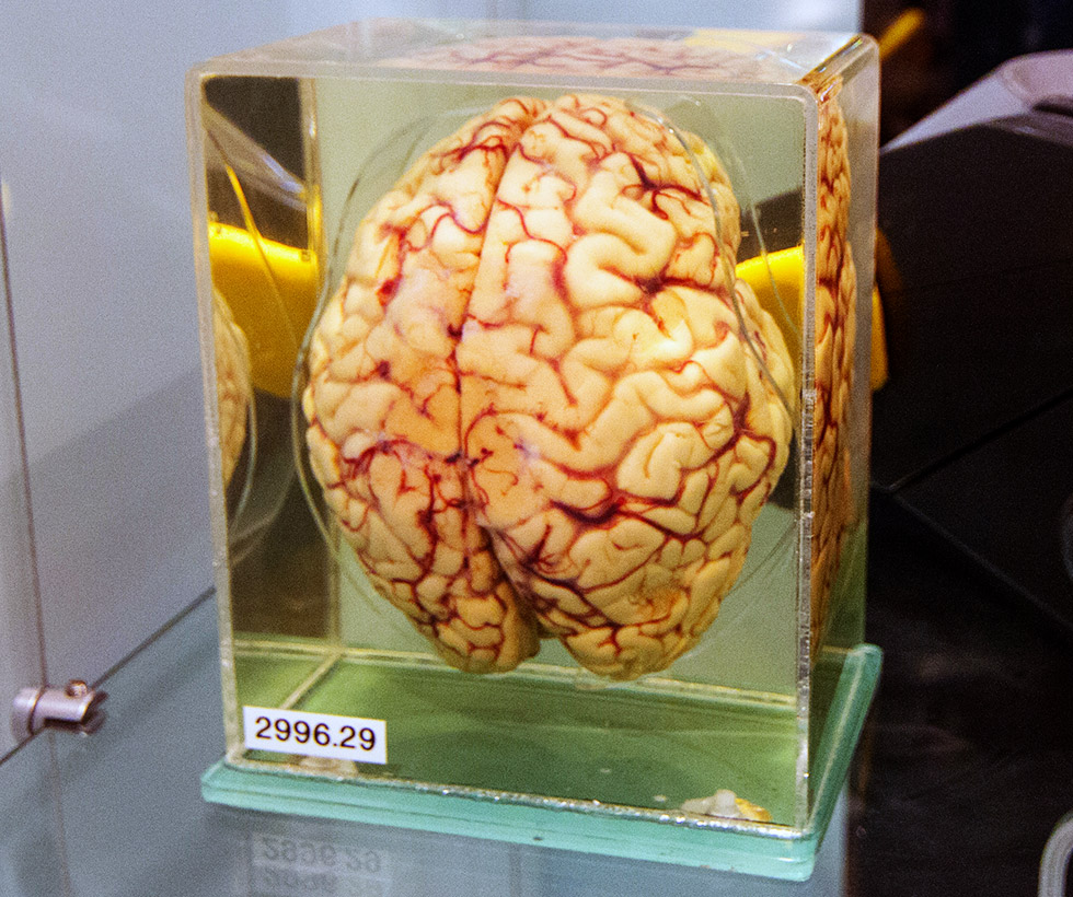Cértebro humano preservado em formaldeído